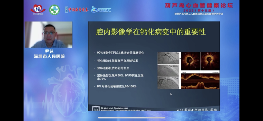葫蘆島心血管健康論壇?2022｜創(chuàng)新驅動發(fā)展，不斷提升心血管疾病救治能力(圖11)